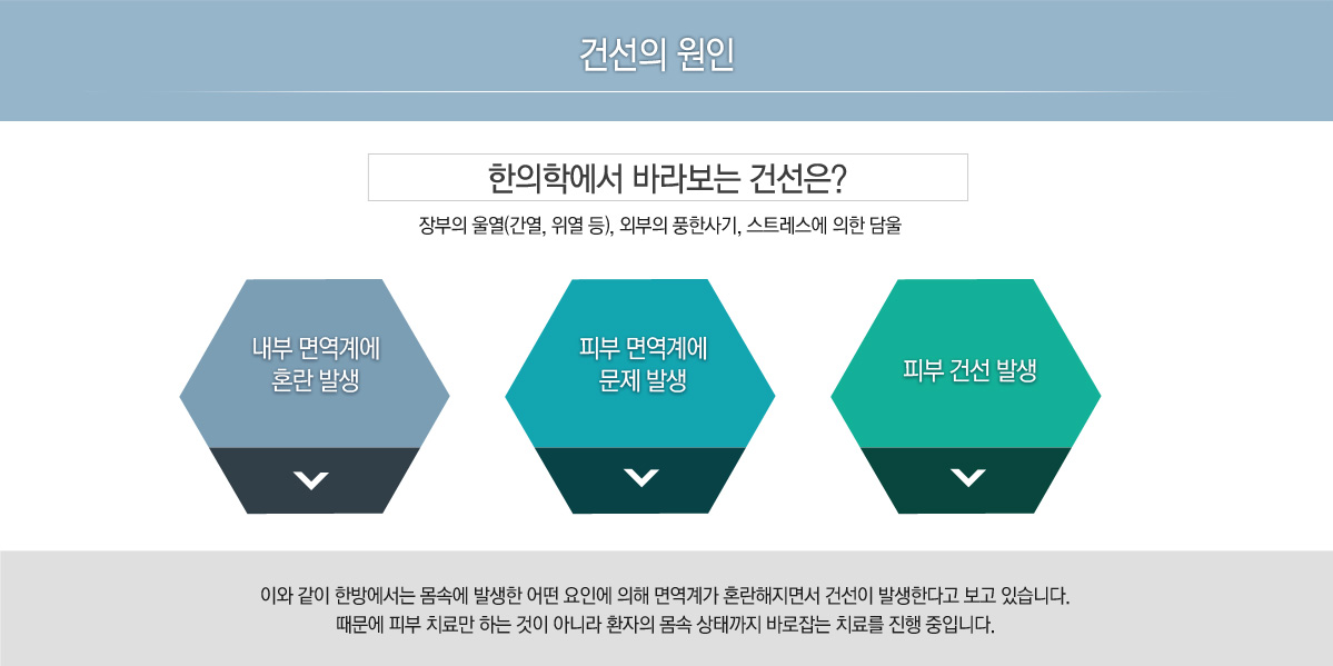 원인