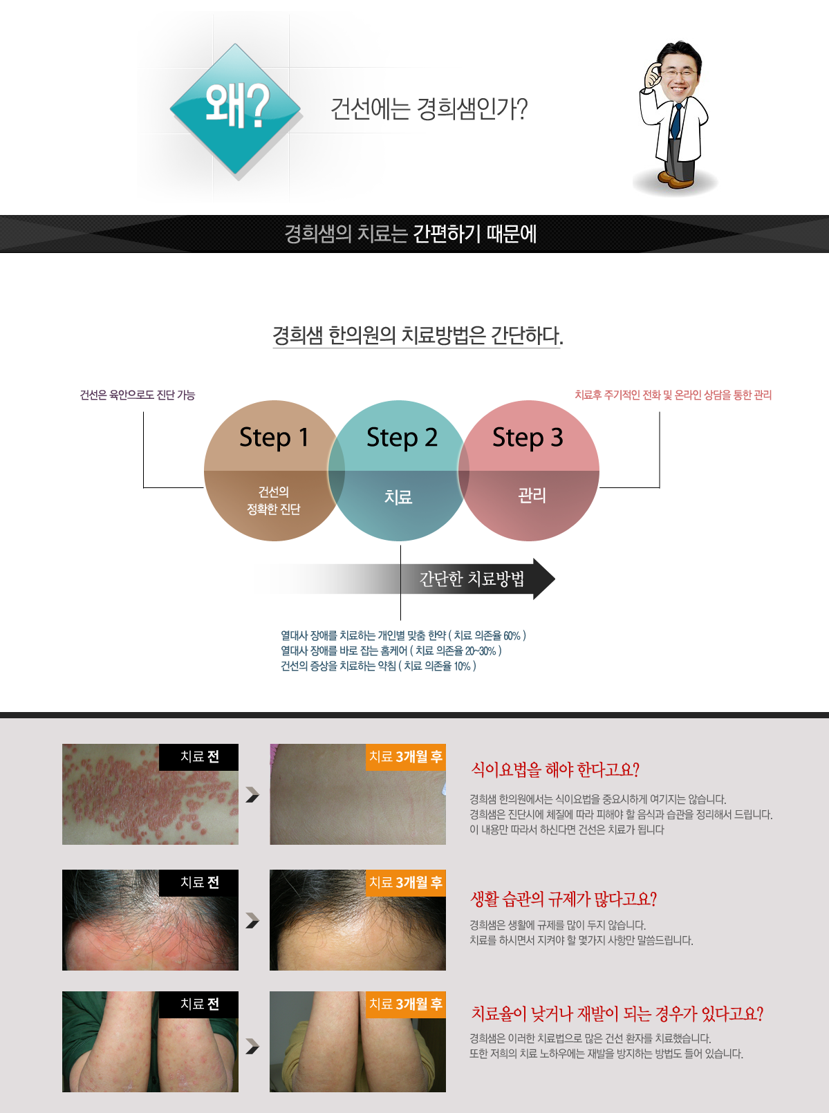간편함